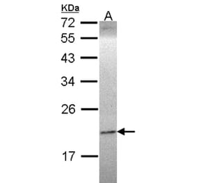Ephrin A1 antibody from Signalway Antibody (22933) - Antibodies.com