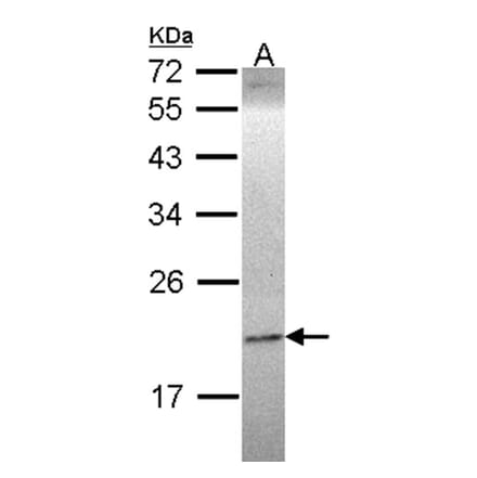 Ephrin A1 antibody from Signalway Antibody (22933) - Antibodies.com