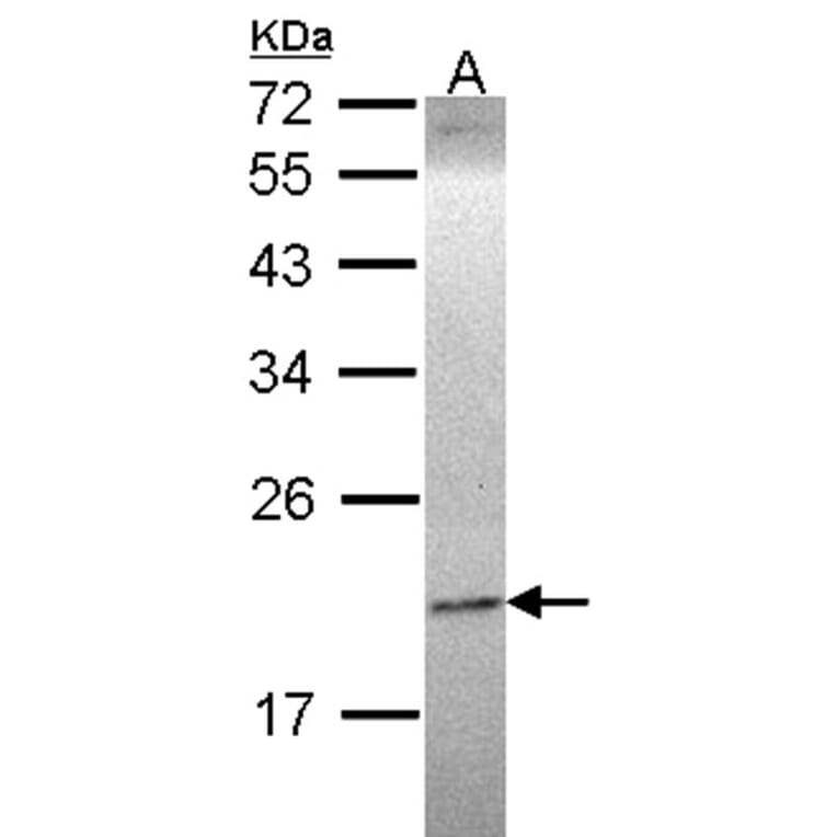 Ephrin A1 antibody from Signalway Antibody (22933) - Antibodies.com