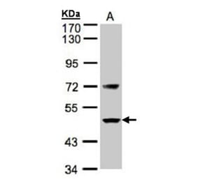 Factor VII antibody from Signalway Antibody (22991) - Antibodies.com