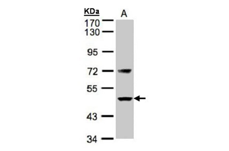 Factor VII antibody from Signalway Antibody (22991) - Antibodies.com