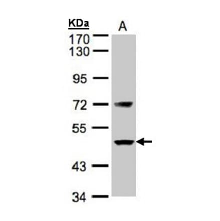 Factor VII antibody from Signalway Antibody (22991) - Antibodies.com