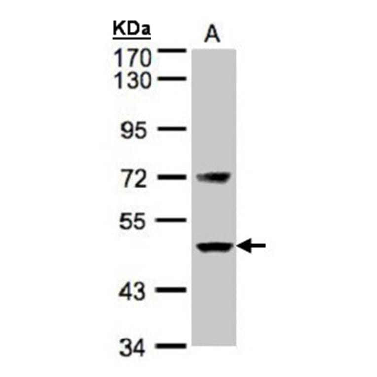 Factor VII antibody from Signalway Antibody (22991) - Antibodies.com