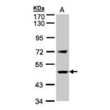 Factor VII antibody from Signalway Antibody (22991) - Antibodies.com