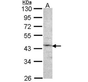 Factor IX antibody from Signalway Antibody (22992) - Antibodies.com