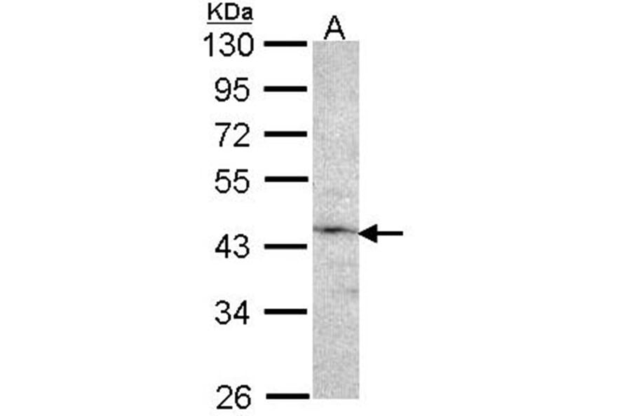 Factor IX antibody from Signalway Antibody (22992) - Antibodies.com