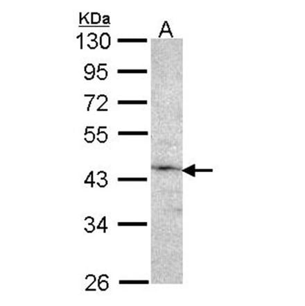 Factor IX antibody from Signalway Antibody (22992) - Antibodies.com