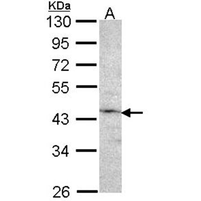 Factor IX antibody from Signalway Antibody (22992) - Antibodies.com