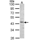 Factor IX antibody from Signalway Antibody (22992) - Antibodies.com