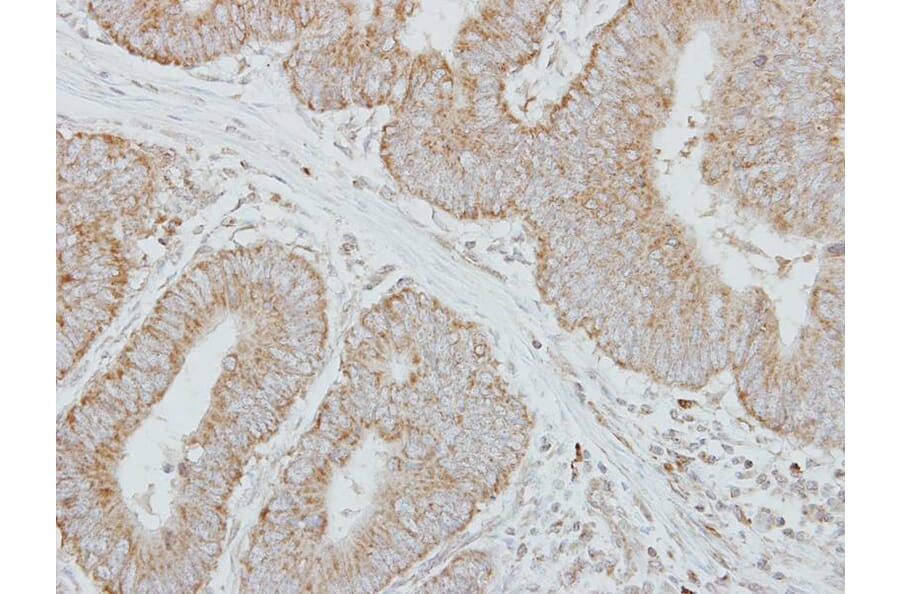 Immunohistochemistry - Factor IX antibody from Signalway Antibody (22992) - Antibodies.com