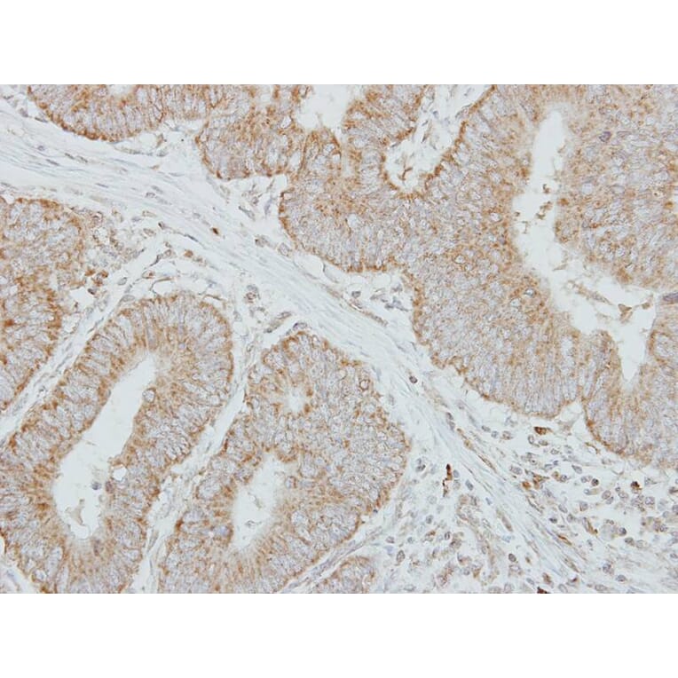 Immunohistochemistry - Factor IX antibody from Signalway Antibody (22992) - Antibodies.com