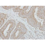 Immunohistochemistry - Factor IX antibody from Signalway Antibody (22992) - Antibodies.com