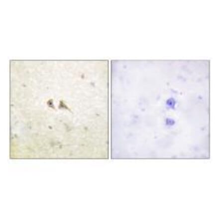 Immunohistochemistry - FAS ligand Antibody from Signalway Antibody (33370) - Antibodies.com