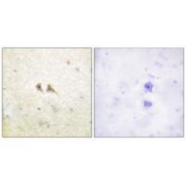 Immunohistochemistry - FAS ligand Antibody from Signalway Antibody (33370) - Antibodies.com