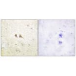 Immunohistochemistry - FAS ligand Antibody from Signalway Antibody (33370) - Antibodies.com