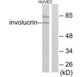 Western blot - Involucrin Antibody from Signalway Antibody (33410) - Antibodies.com