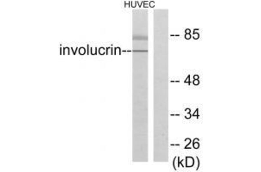 Western blot - Involucrin Antibody from Signalway Antibody (33410) - Antibodies.com