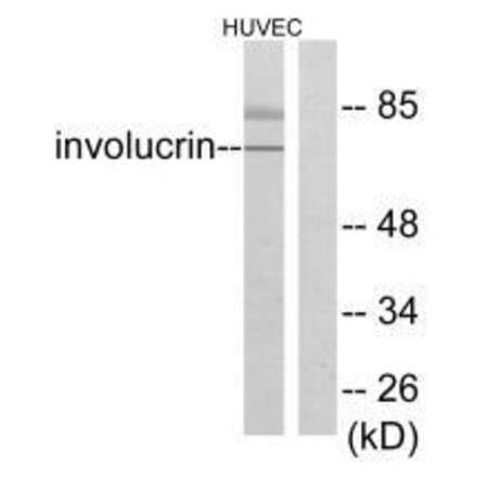 Western blot - Involucrin Antibody from Signalway Antibody (33410) - Antibodies.com