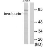 Western blot - Involucrin Antibody from Signalway Antibody (33410) - Antibodies.com