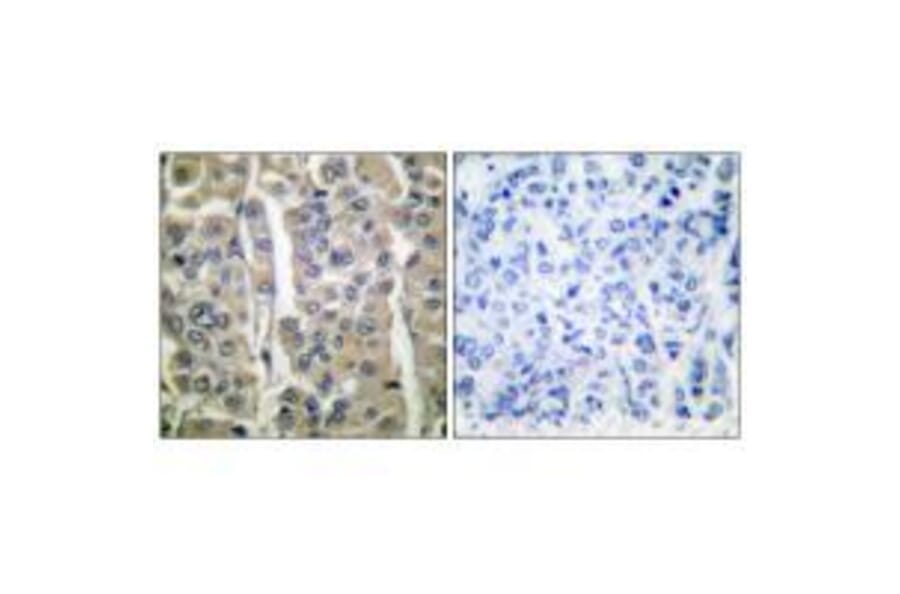 Immunohistochemistry - Involucrin Antibody from Signalway Antibody (33410) - Antibodies.com