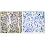 Immunohistochemistry - Involucrin Antibody from Signalway Antibody (33410) - Antibodies.com
