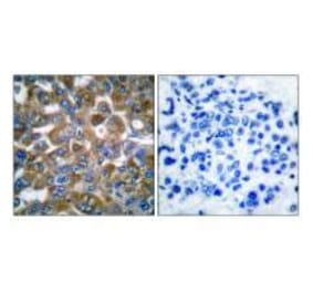 Immunohistochemistry - Keratin 15 Antibody from Signalway Antibody (33413) - Antibodies.com