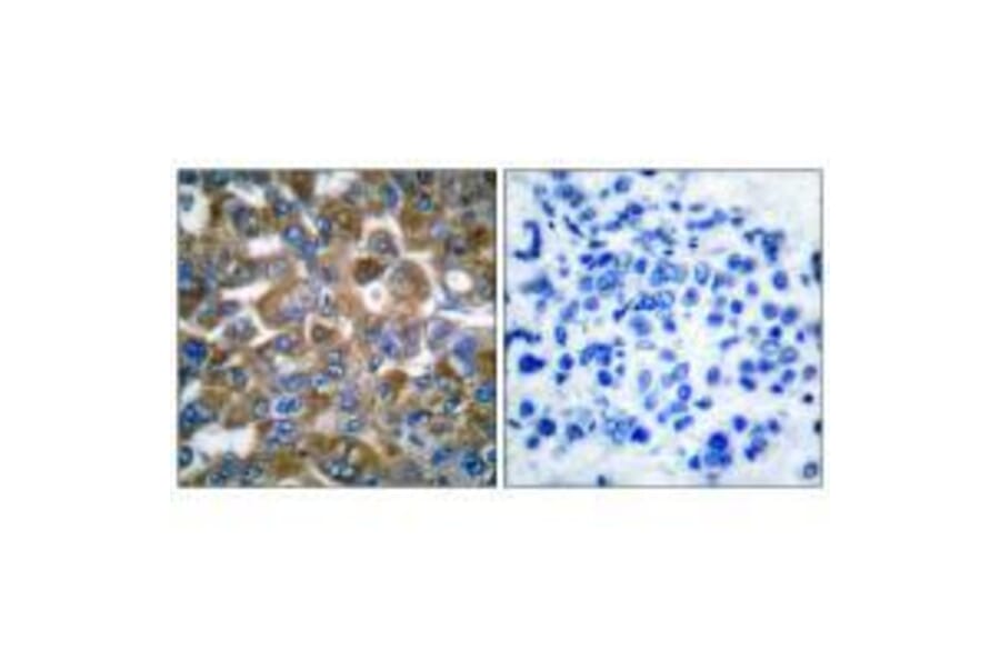 Immunohistochemistry - Keratin 15 Antibody from Signalway Antibody (33413) - Antibodies.com