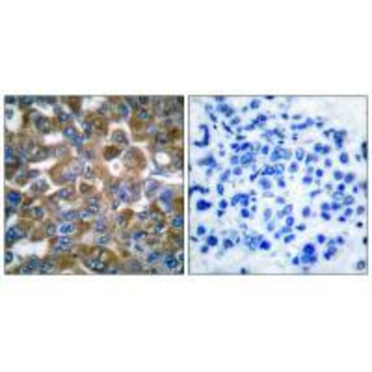 Immunohistochemistry - Keratin 15 Antibody from Signalway Antibody (33413) - Antibodies.com