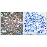 Immunohistochemistry - Keratin 15 Antibody from Signalway Antibody (33413) - Antibodies.com