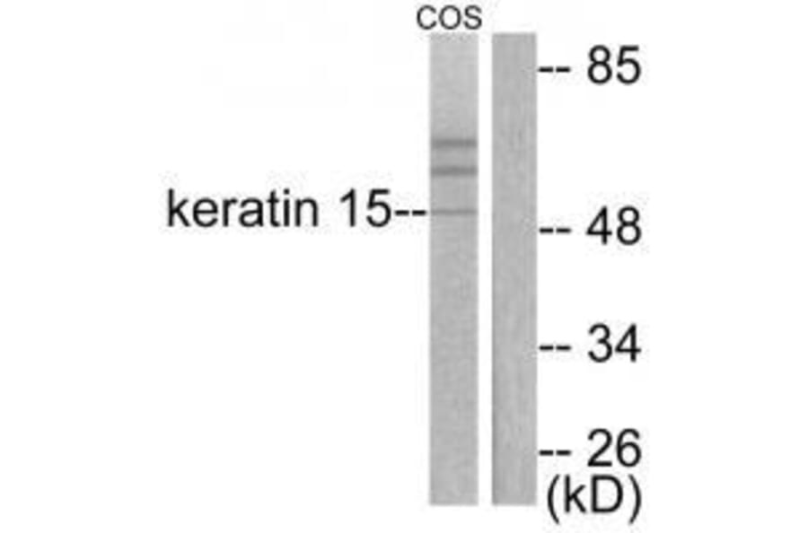 Western blot - Keratin 15 Antibody from Signalway Antibody (33413) - Antibodies.com