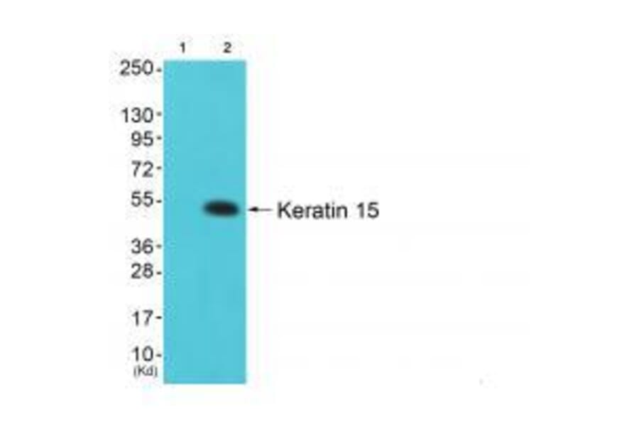 Western blot - Keratin 15 Antibody from Signalway Antibody (33413) - Antibodies.com