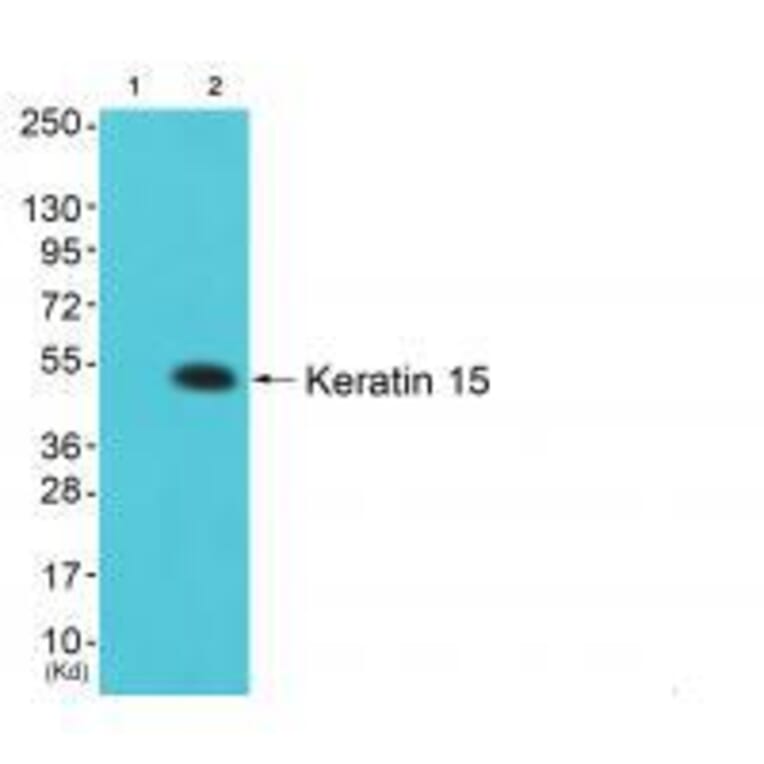 Western blot - Keratin 15 Antibody from Signalway Antibody (33413) - Antibodies.com