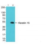 Western blot - Keratin 15 Antibody from Signalway Antibody (33413) - Antibodies.com
