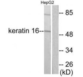 Western blot - Keratin 16 Antibody from Signalway Antibody (33414) - Antibodies.com