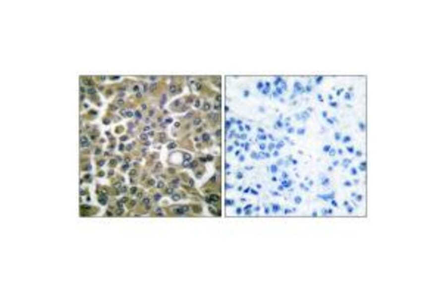 Immunohistochemistry - Keratin 16 Antibody from Signalway Antibody (33414) - Antibodies.com