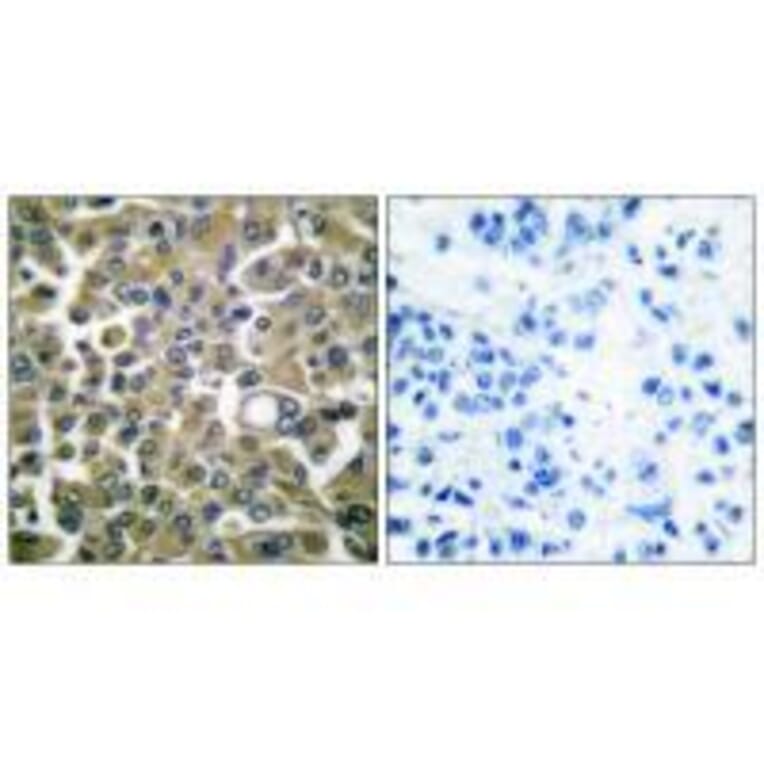 Immunohistochemistry - Keratin 16 Antibody from Signalway Antibody (33414) - Antibodies.com