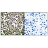 Immunohistochemistry - Keratin 16 Antibody from Signalway Antibody (33414) - Antibodies.com