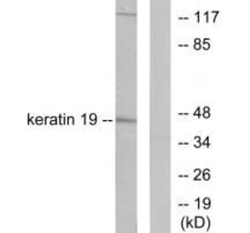 Western blot - Keratin 19 Antibody from Signalway Antibody (33417) - Antibodies.com