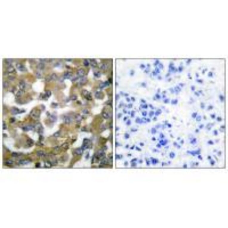 Immunohistochemistry - Keratin 19 Antibody from Signalway Antibody (33417) - Antibodies.com