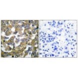 Immunohistochemistry - Keratin 19 Antibody from Signalway Antibody (33417) - Antibodies.com