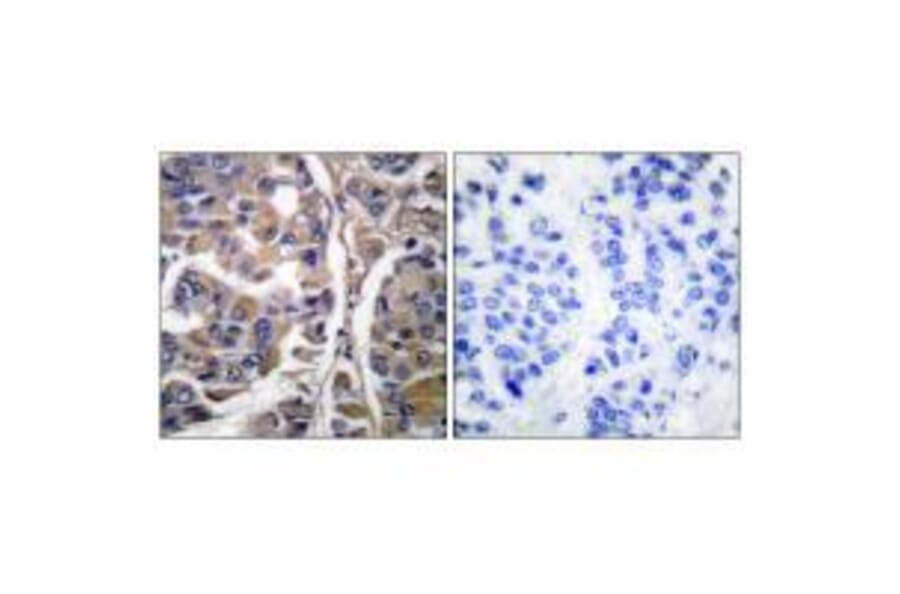 Immunohistochemistry - Keratin 20 Antibody from Signalway Antibody (33418) - Antibodies.com
