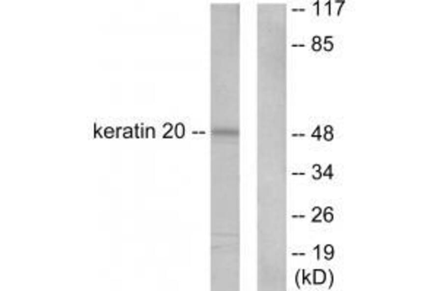 Western blot - Keratin 20 Antibody from Signalway Antibody (33418) - Antibodies.com