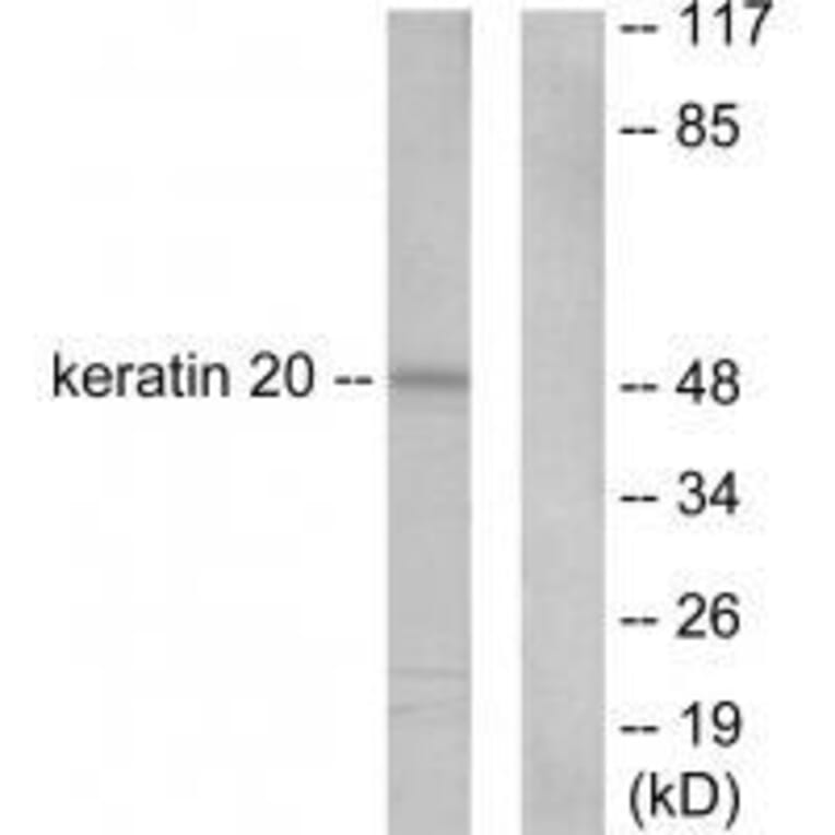 Western blot - Keratin 20 Antibody from Signalway Antibody (33418) - Antibodies.com