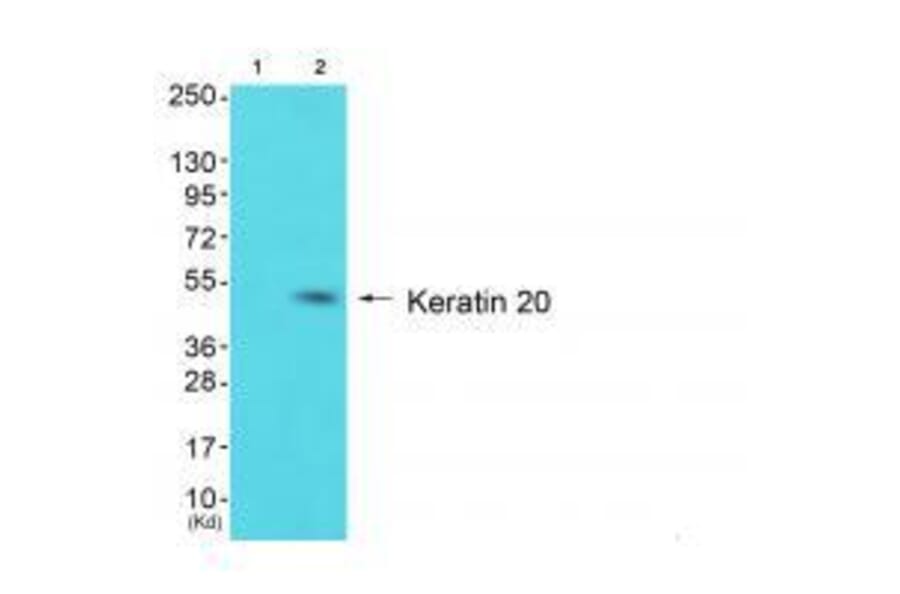 Western blot - Keratin 20 Antibody from Signalway Antibody (33418) - Antibodies.com