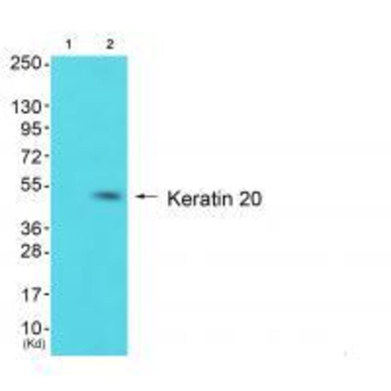 Western blot - Keratin 20 Antibody from Signalway Antibody (33418) - Antibodies.com