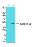 Western blot - Keratin 20 Antibody from Signalway Antibody (33418) - Antibodies.com