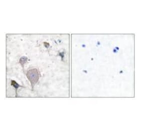 Immunohistochemistry - Peripherin Antibody from Signalway Antibody (33471) - Antibodies.com
