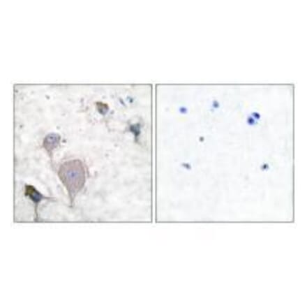 Immunohistochemistry - Peripherin Antibody from Signalway Antibody (33471) - Antibodies.com