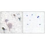 Immunohistochemistry - Peripherin Antibody from Signalway Antibody (33471) - Antibodies.com