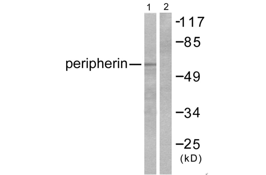 Western blot - Peripherin Antibody from Signalway Antibody (33471) - Antibodies.com
